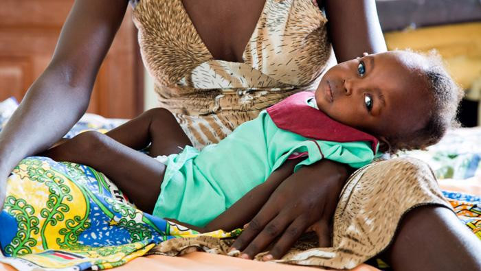 14 Millionen Kindern Droht Der Hungertod Unicefch 