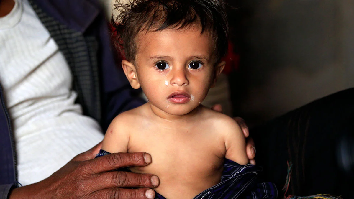 © UNICEF/UN0275788/ Huwais